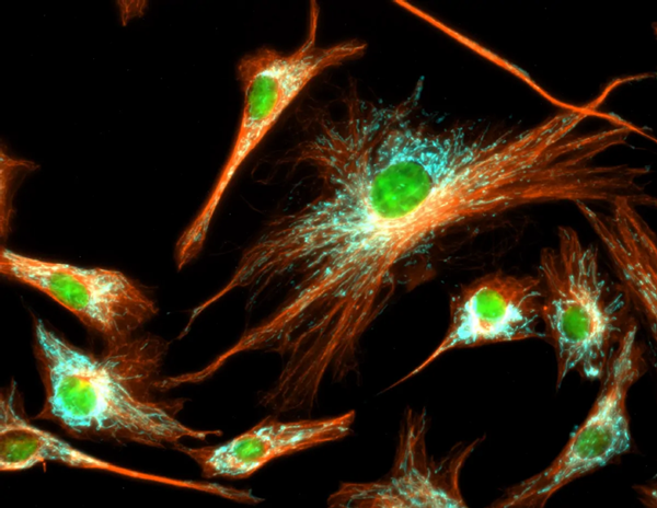 Analyse en immunofluorescence de la tubuline dans les cellules BPAE avec superposition des mitochondries (ATP synthase, cyan), de la tubuline (orange) et des noyaux (vert)