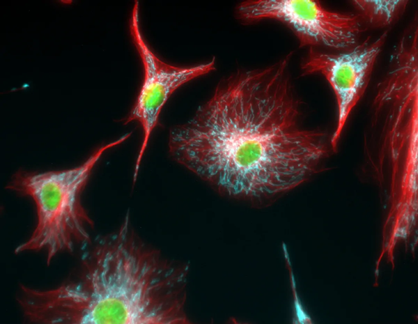 Analyse en immunofluorescence de la tubuline dans les cellules BPAE avec superposition des mitochondries (ATP synthase, cyan), de la tubuline (rouge) et des noyaux (vert)